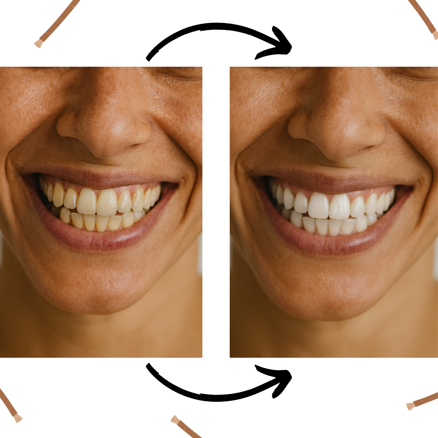 Premium Natuurlijke Miswak (Siwak) - 5 Stuks + Beschermkoker